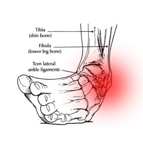 Ankle inversion