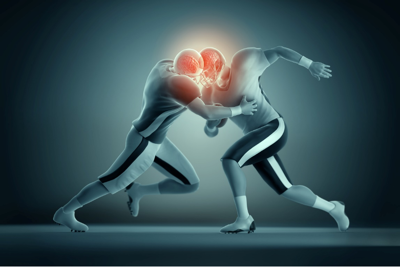 Concussion injuries managed by a physiotherapist